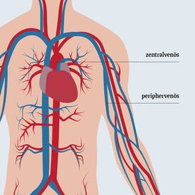 Infusionssysteme