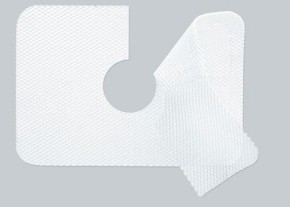 Produktbeispiel: Titanisiertes Netzimplantat zur chirurgischen Anwendung (pfm medical titanium) Produktbeispiel: Titanisiertes Netzimplantat zur chirurgischen Anwendung (pfm medical titanium)