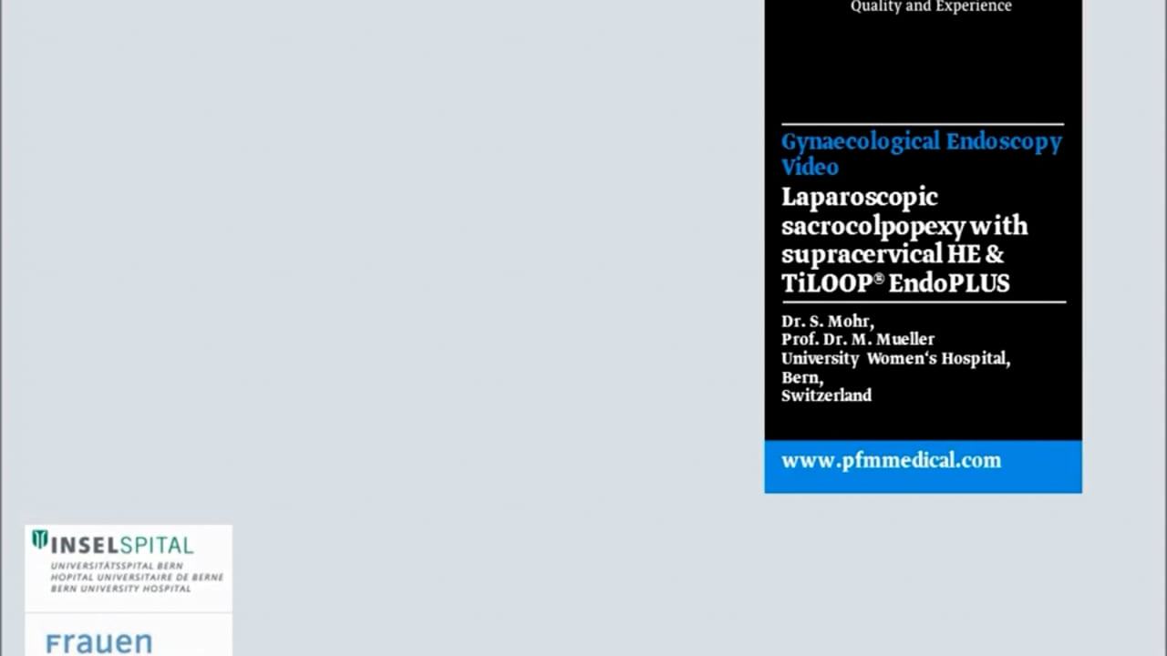 Sakrokolpopexie und suprazervikale Hysterektomie mit TiLOOP&reg; SCP Y-Mesh (fr&uuml;her: EndoPLUS)