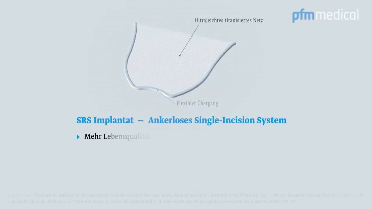SRS Implantat (Self-Retaining Support) - OP-Video mit Interview