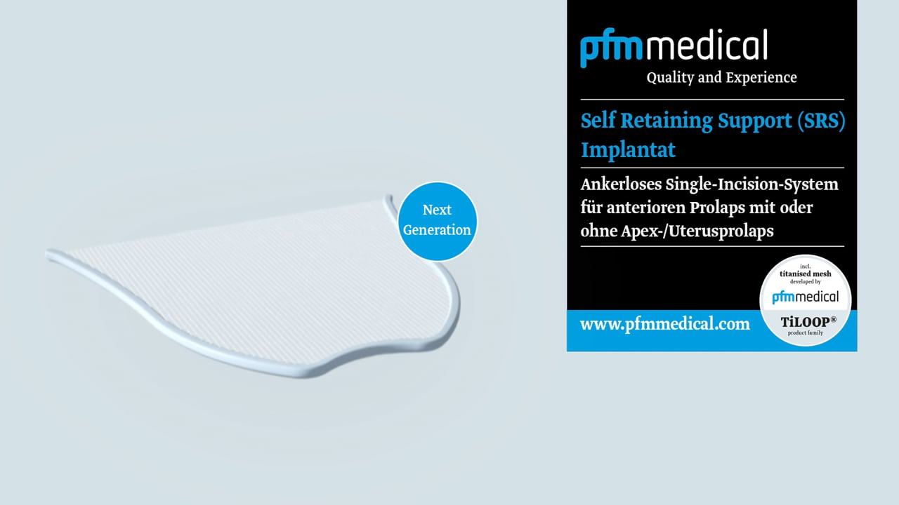 Animation: SRS-Implantat (DE)