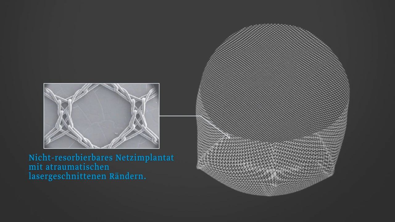 Animation-TiLOOP-Bra-Pocket_DE