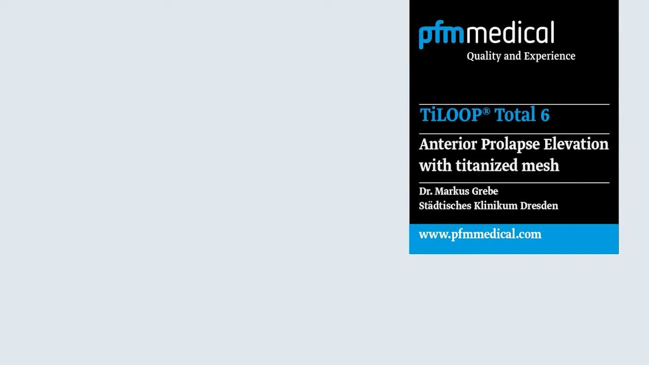 Transvaginale anteriore Rekonstruktion mit TiLOOP&reg; Total 6