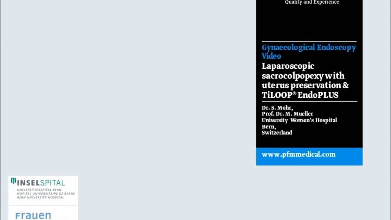 Sakrokolpopexie mit Uteruserhalt mit TiLOOP&reg; SCP Y-Mesh (ex: EndoPLUS)